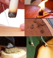 Different types of Moxibustion