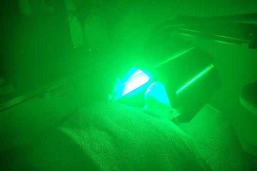 Green LED light therapy