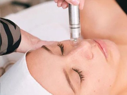 Microneedling treatment at Ella Baché Hobart