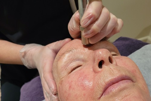 Microdermabrasion treatment at Ella Baché Hobart