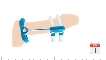 Quick Extender Pro penis traction device