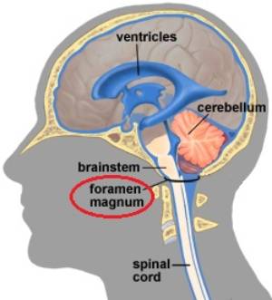 Foramen magnum